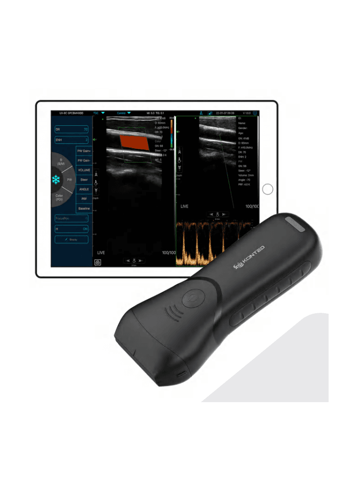 ECHOVASCUGENIUS PRO