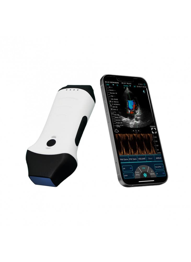 eCHOCARDIOVASCUGENIUS II