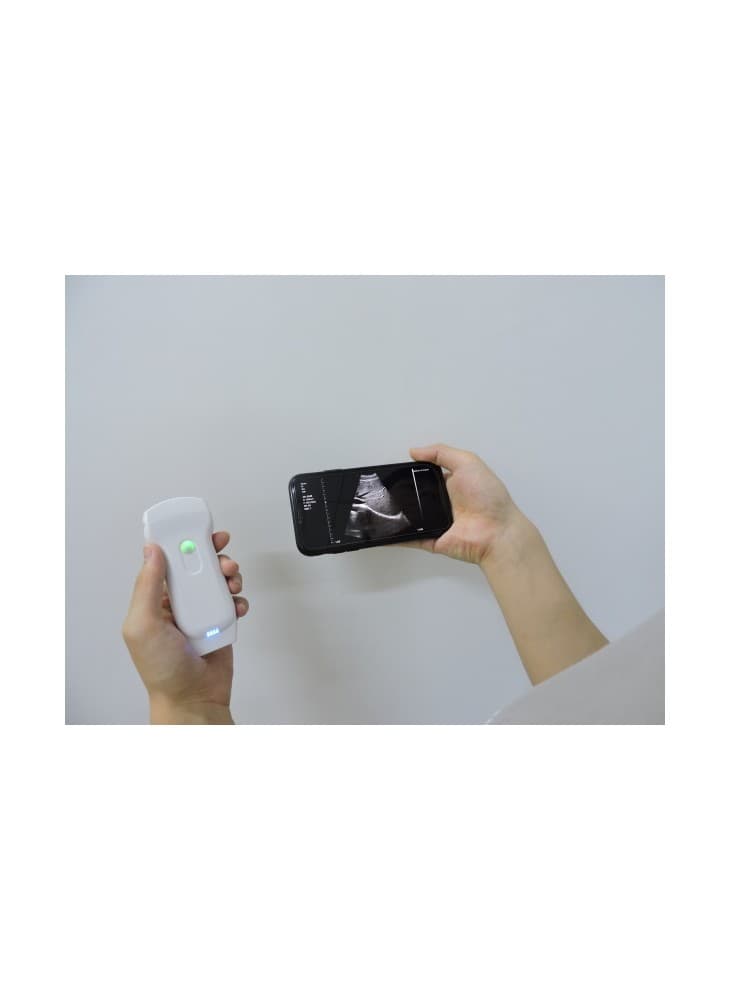 eCHOGENIUS, échographe personnel