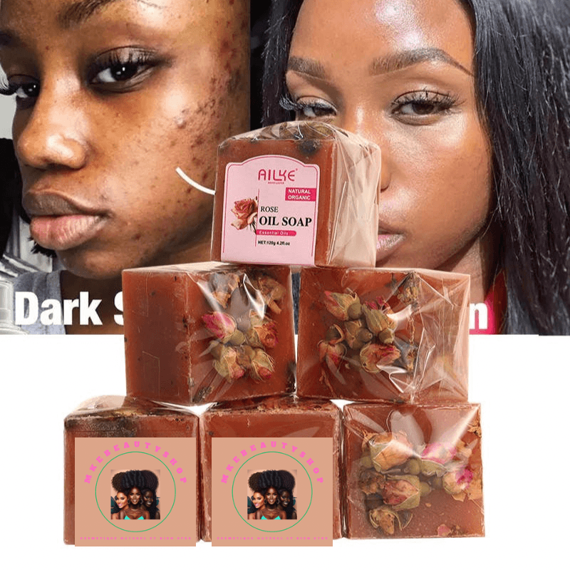 Savon anti taches, anti acné